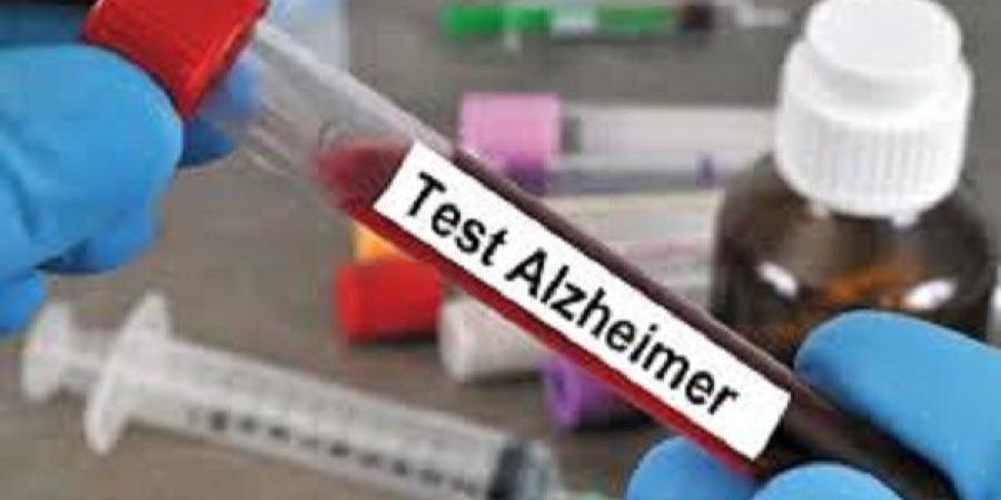 الغذاء والدواء الأميركية تعتمد أول اختبار دم لتشخيص الزهايمر - تكنو بلس