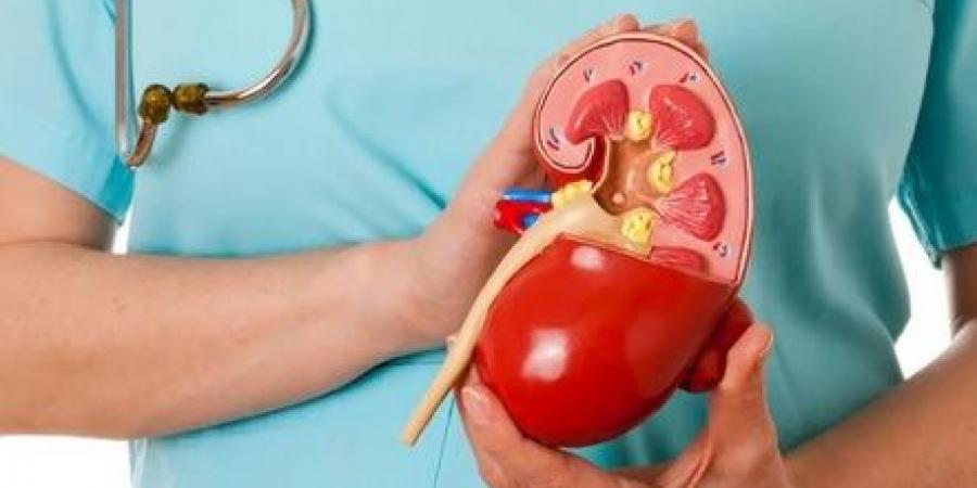 حصوات الكلى تهددك في الصيف... تجنّبها بهذه النصائح - تكنو بلس