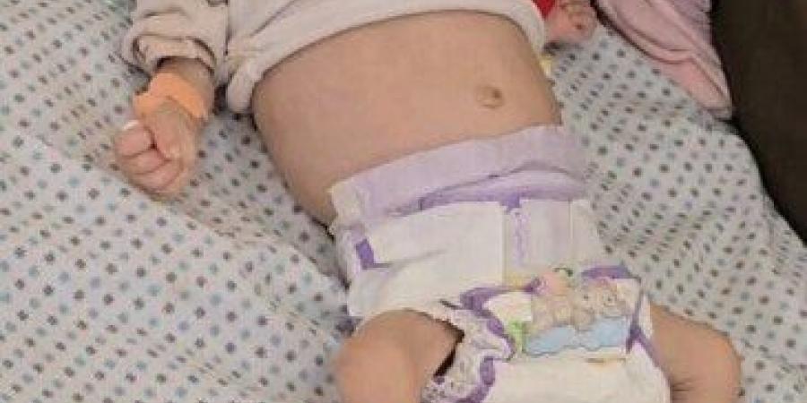 «سلاح التجويع» أهالي غزة يدخلون المرحلة الخامسة.. و«الأسبوع» توثق قتل البراءة في القطاع - تكنو بلس