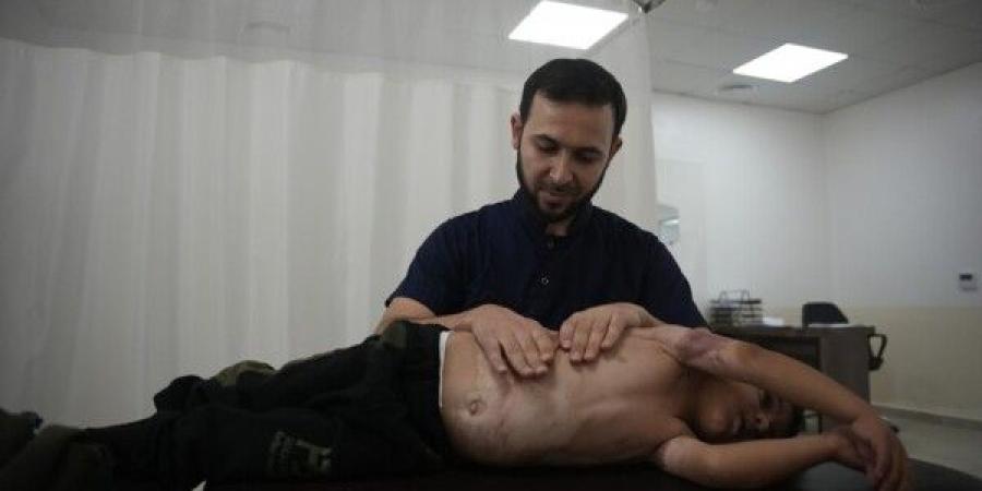 أطباء بلا حدود: إصابات الحروق تتفاقم في مخيمات شمال غرب سوريا وسط تراجع الدعم الدولي - تكنو بلس