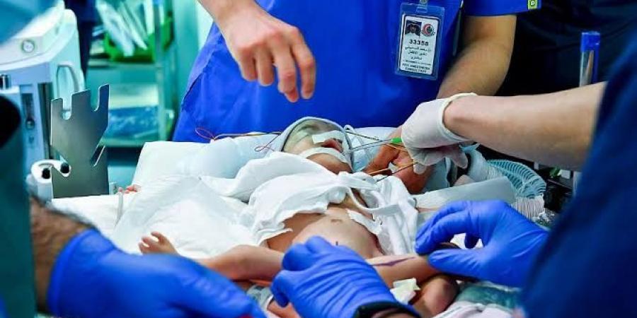 فصل توأم طفيلي مصري في عملية جراحية معقدة بالرياض - تكنو بلس