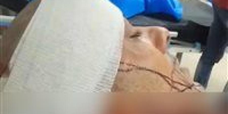 محاولة سرقة تنتهي بجريمة طعن.. إصابة شاب بـ21 غرزة والمتهم ما زال هاربًا ويُهدد المجني عليه - تكنو بلس